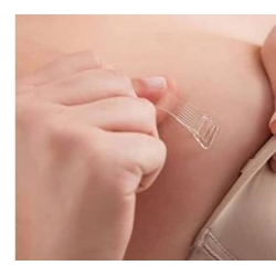 Tirante de silicona - Imagen 2